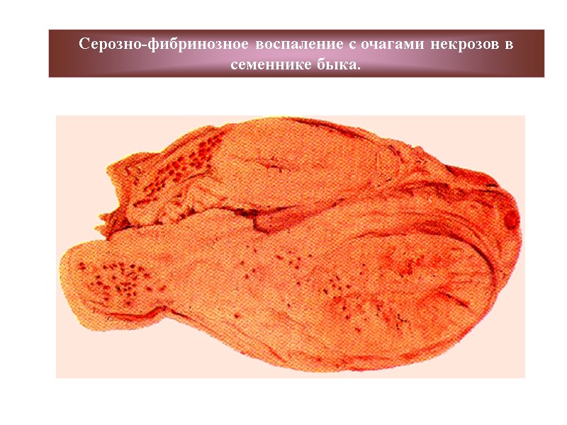 Серозно-фибринозное воспаление с очагами некрозов в семеннике быка.